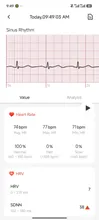 Avis clients – Bracelet connecté ECG HRV santé 3ATM