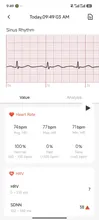 Avis clients – Bracelet connecté ECG HRV santé 3ATM