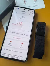 Avis clients – Montre connectée santé ECG tension artérielle