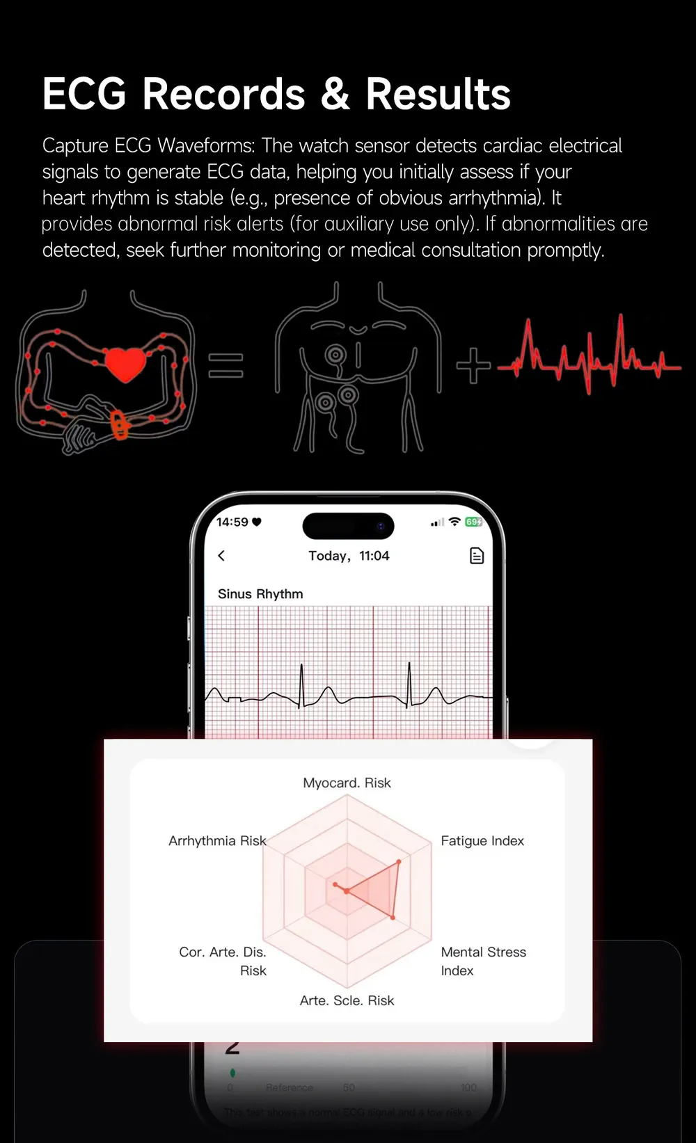 Montre connectée santé ECG PPG homme femme